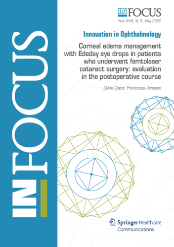Download: Corneal edema management  with Ededay eye drops in patients  who underwent femtolaser  cataract surgery